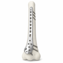 Bone Plate Pedestal Gage
