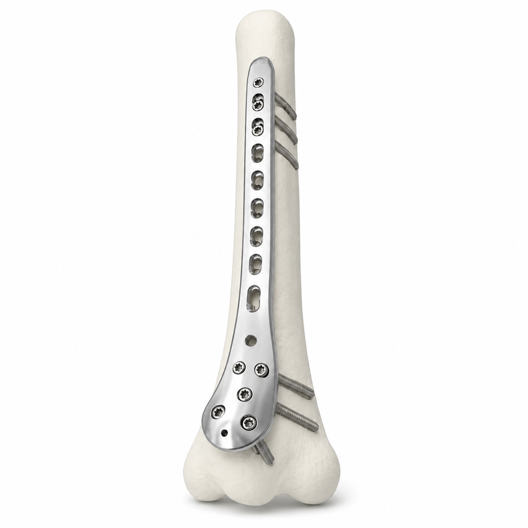 Bone Plate Pedestal Gage