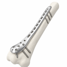 WESTport Bone Plate Pedestal Gage